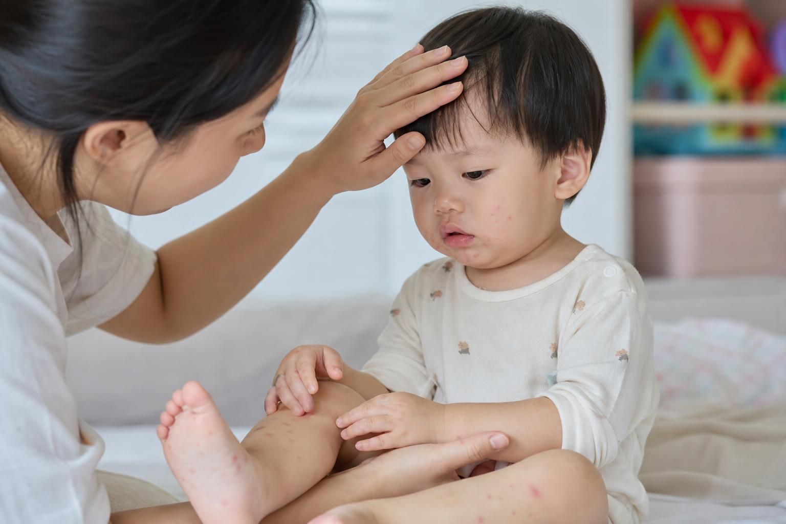 [수족구병, 어린이, 물집] 기사 핵심 맥락을 보여주는 이미지 - 질병관리청은 지난달 31일~이달 6일 전국 109개 표본감시 의료기관을 대상으로 수족구병 의심 환자 규모를 집계했다. 그 결과, 1000명당 의...